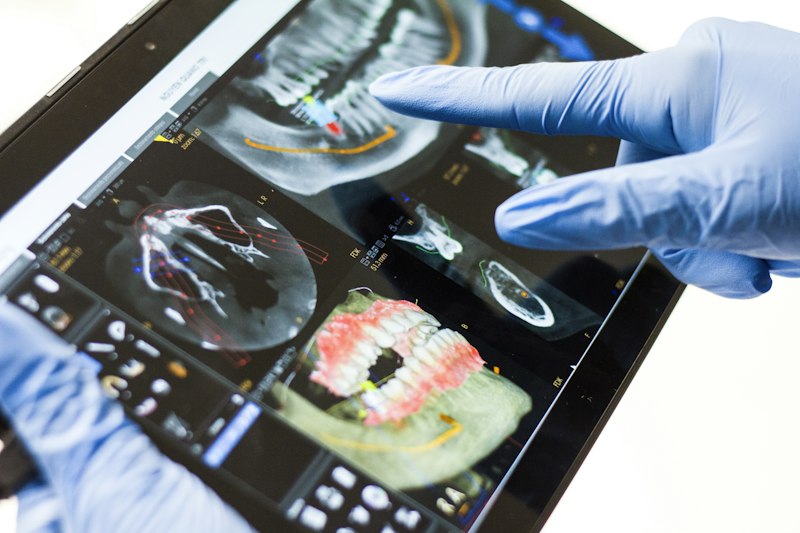 Profissional analisando escaneamento dental em tablet