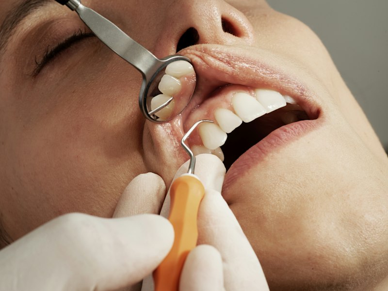 Dentista realizando exame com espelho clínico