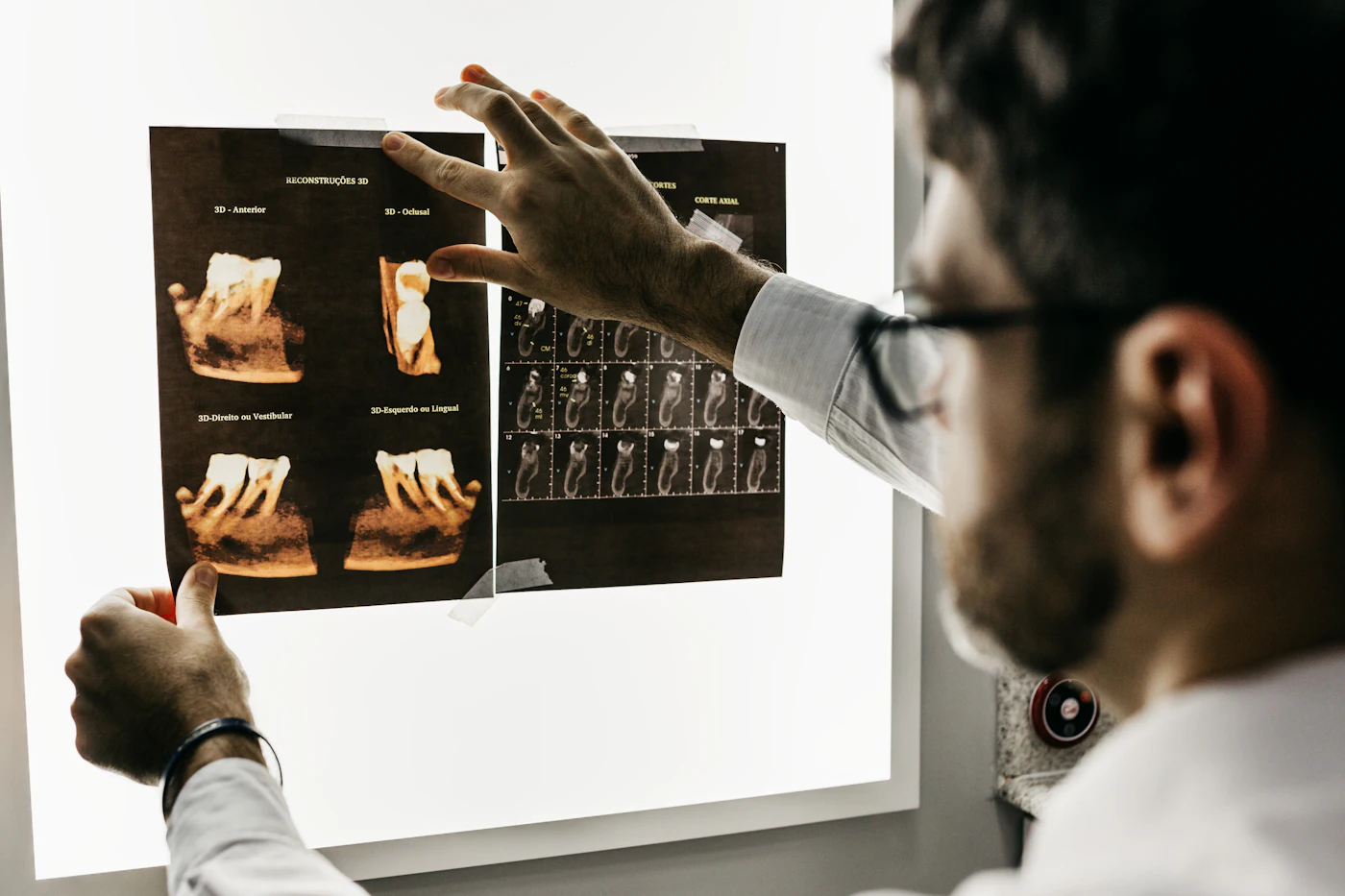 Dentista analisando radiografias para o planejamento do tratamento