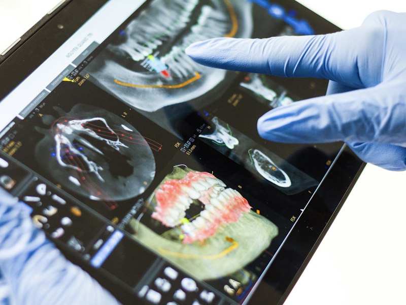 Planejamento digital de sorriso em tablet