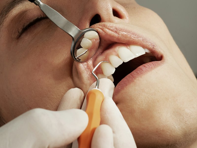 Profilaxia dental com instrumental